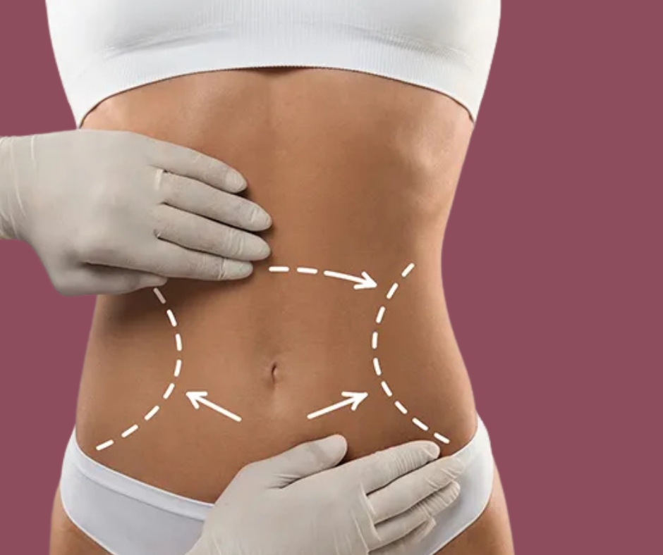 Image is not available